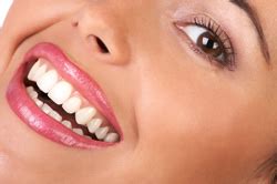 Tooth whitening in Leatherhead, Surrey, Ashtead, Tyrells Wood, .